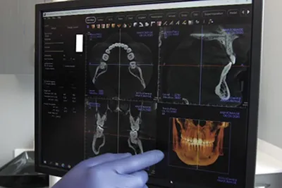 Advanced dental imaging at Boston dental office